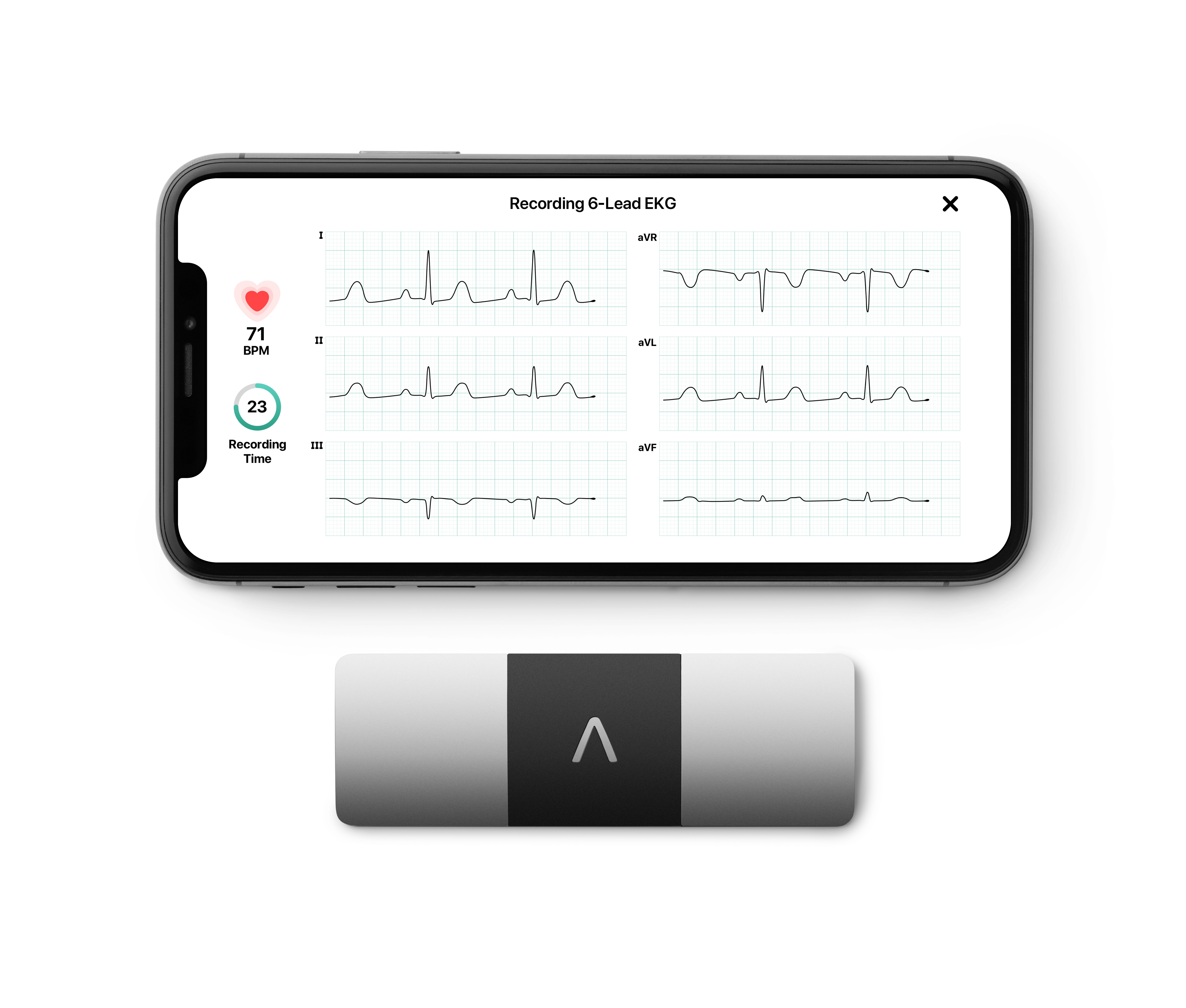 Aparaty EKG mobilne AliveCor KardiaMobile 6L
