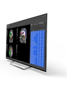 Diagnostyka obrazowa - oprogramowanie Imagylis Brainmagix