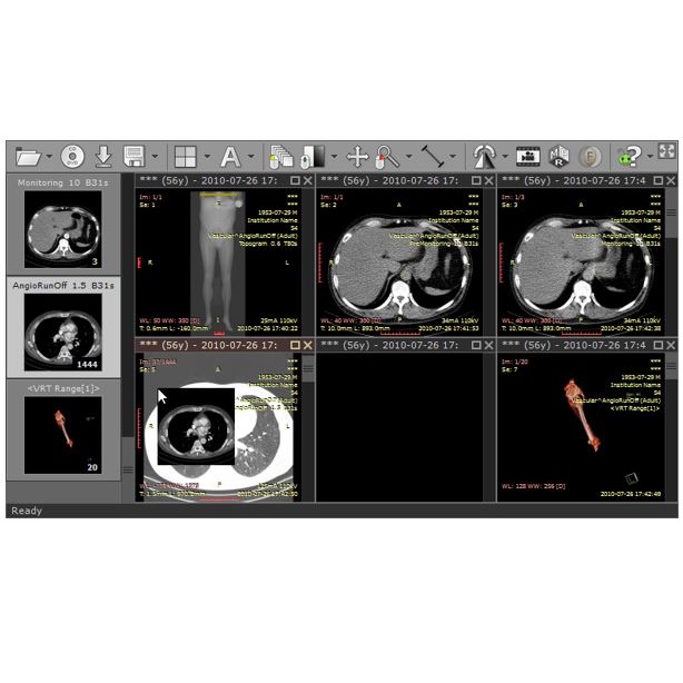 Diagnostyka obrazowa - oprogramowanie RadiAnt RadiAnt DICOM VIEWER