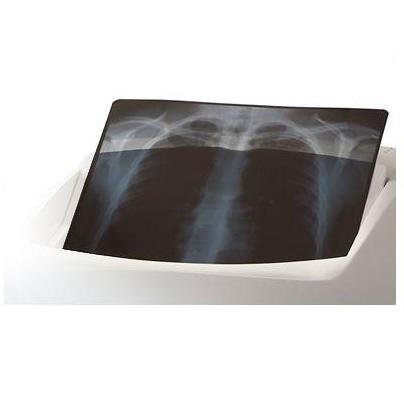 Filmy RTG – drukarki rentgenowskie Carestream Ektascan HN