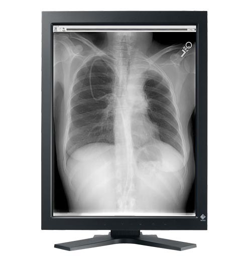 Monitory medyczne Eizo RadiForce GS310