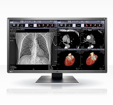 Monitory medyczne Eizo RadiForce MX315W