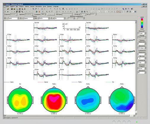 Oprogramowanie do analizy EEG Mitsar WinEEG