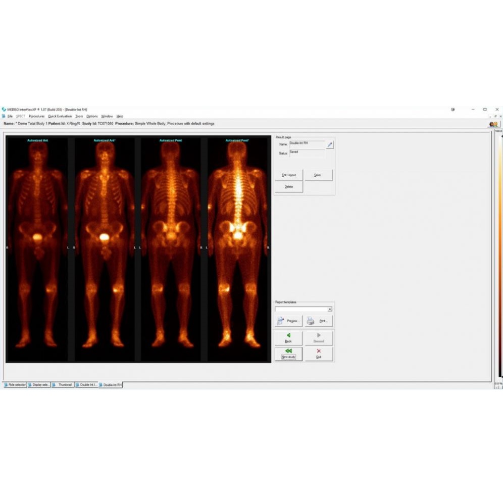 Oprogramowanie do diagnostyki obrazowej do medycyny nuklearnej Mediso Interview XP