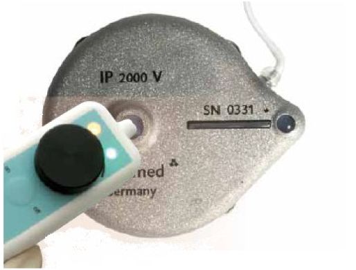 Pompy infuzyjne implantowane Tricumed IP2000V