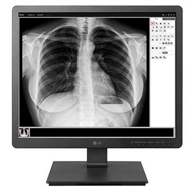 Systemy ucyfrowienia aparatów rentgenowskich LG DXD