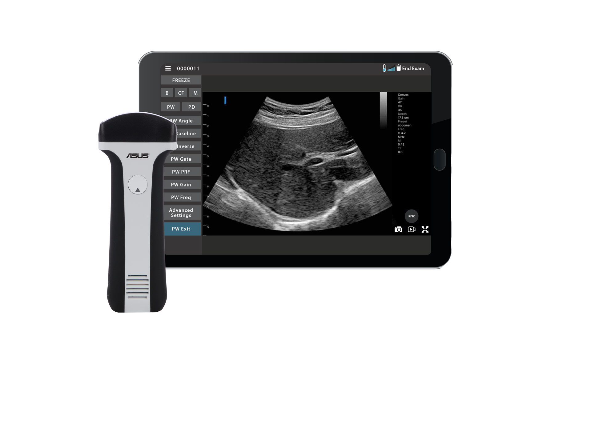Ultrasonografy kieszonkowe ręczne (USG) ASUS LU700C