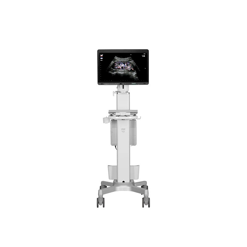 Ultrasonografy mobilne przyłóżkowe FUJIFILM Arietta Precision