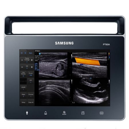 Ultrasonografy mobilne przyłóżkowe Samsung PT60A