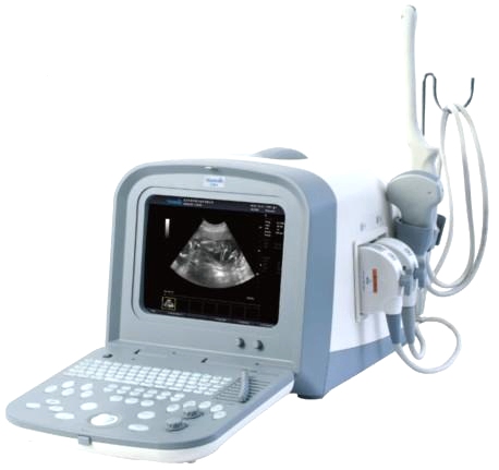 Ultrasonografy mobilne przyłóżkowe Teknova TH-100