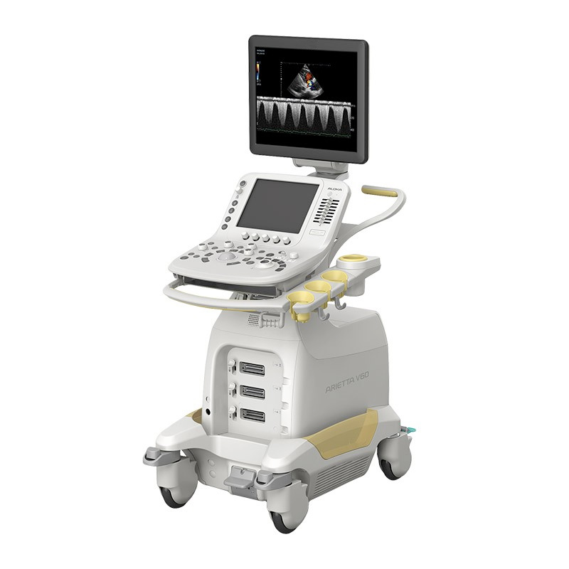 Ultrasonografy stacjonarne wielonarządowe - USG FUJIFILM ARIETTA V60