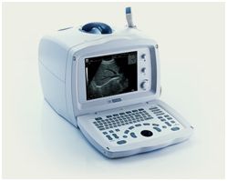 Ultrasonografy stacjonarne wielonarządowe - USG MINDRAY DP-2200