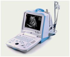Ultrasonografy stacjonarne wielonarządowe - USG MINDRAY DP-3300