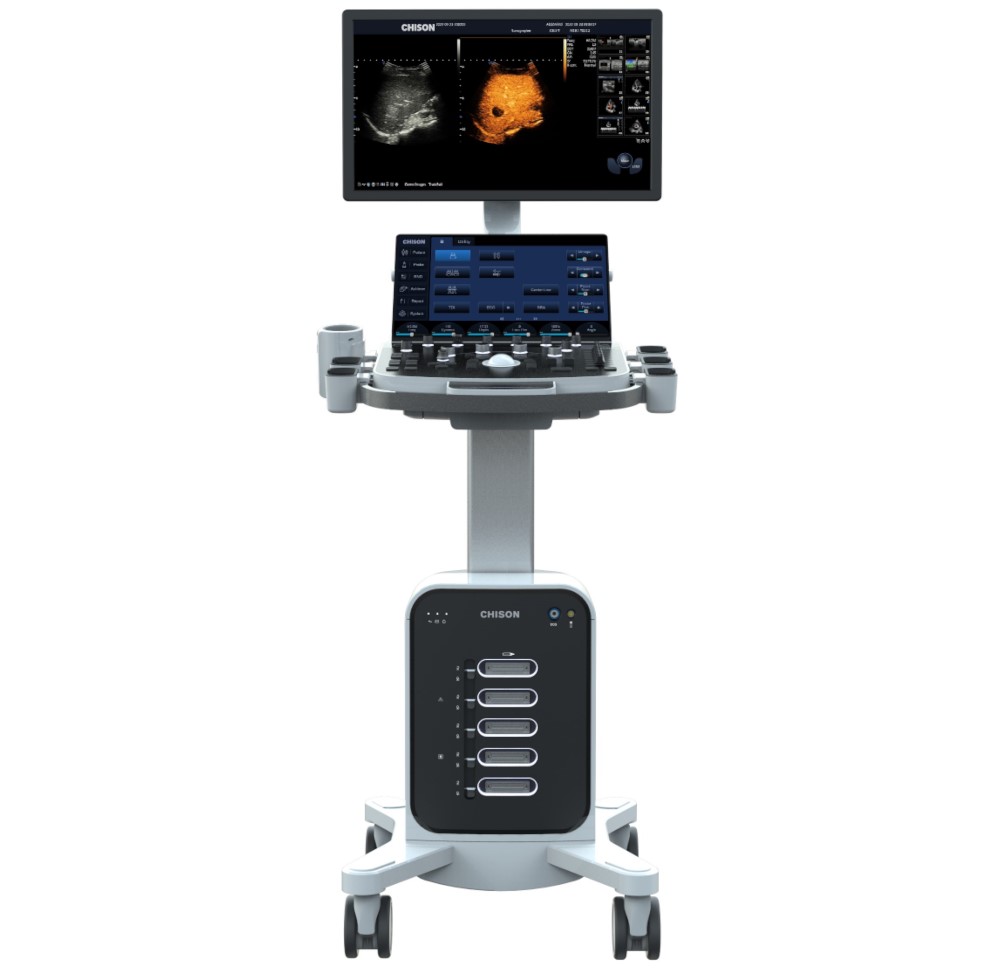 Ultrasonografy stacjonarne wielonarządowe - USG CHISON SonoMax9
