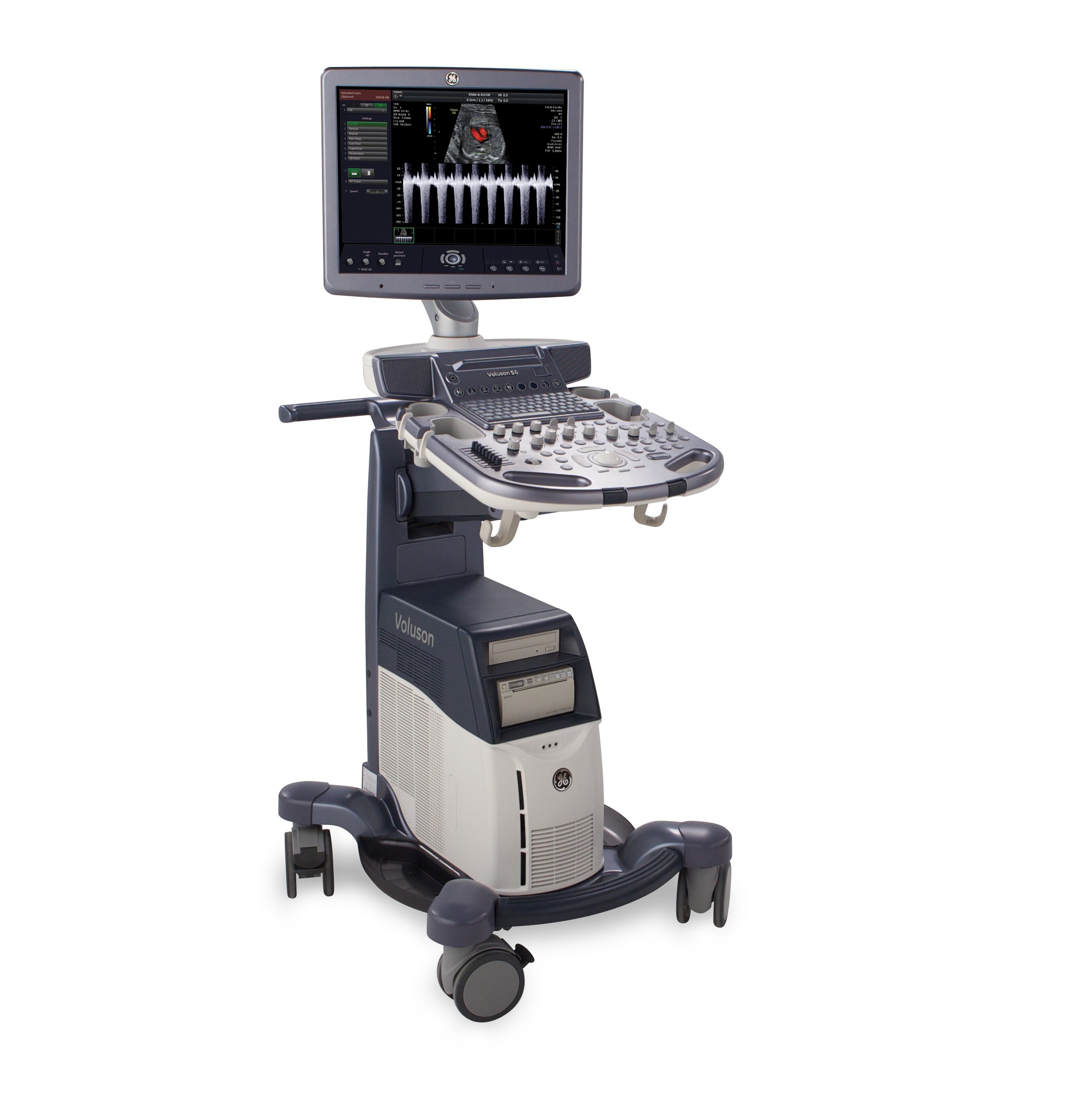 Ultrasonografy stacjonarne wielonarządowe - USG GE Healthcare VOLUSON S6 np