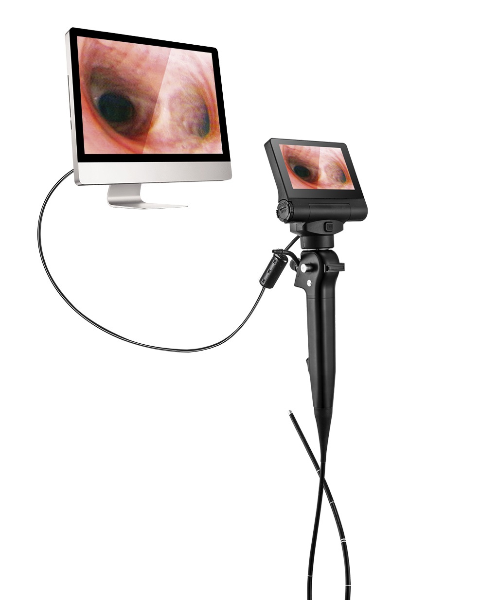 Videobronchoskopy MDH A41