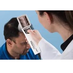 Videotrichoskopy CANFIELD HairMetrix