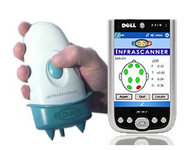 Detektory krwawień śródczaszkowych InfraScan Infrascanner