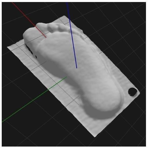 Podoskopy Koordynacja Podoscan 3D – Laser Foot Scanner