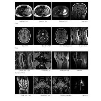 Rezonans magnetyczny (MRI) ANKE MRI OPENMARK 4000 0.4T
