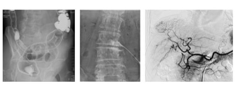 RTG zdalnie sterowane, uniwersalne do radiografii i fluoroskopii Shimadzu Corporation Sonialvision G4