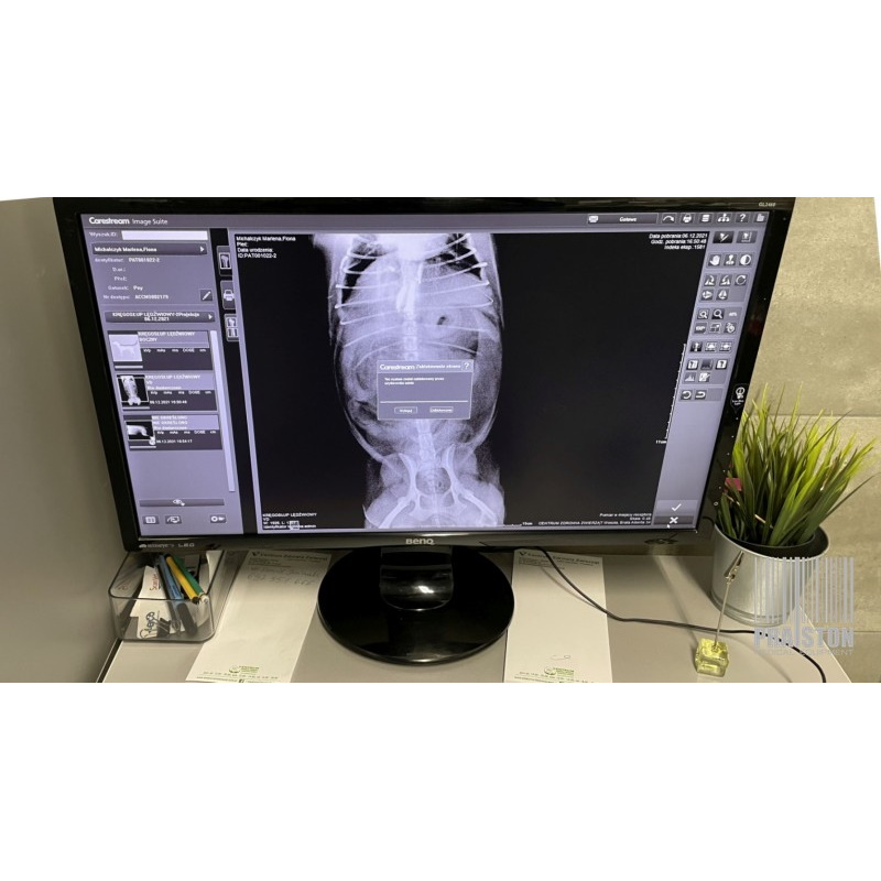 Skanery płyt obrazowych (radiografia pośrednia) używane B/D CARESTREAM VITA FLEX CR - Praiston rekondycjonowany