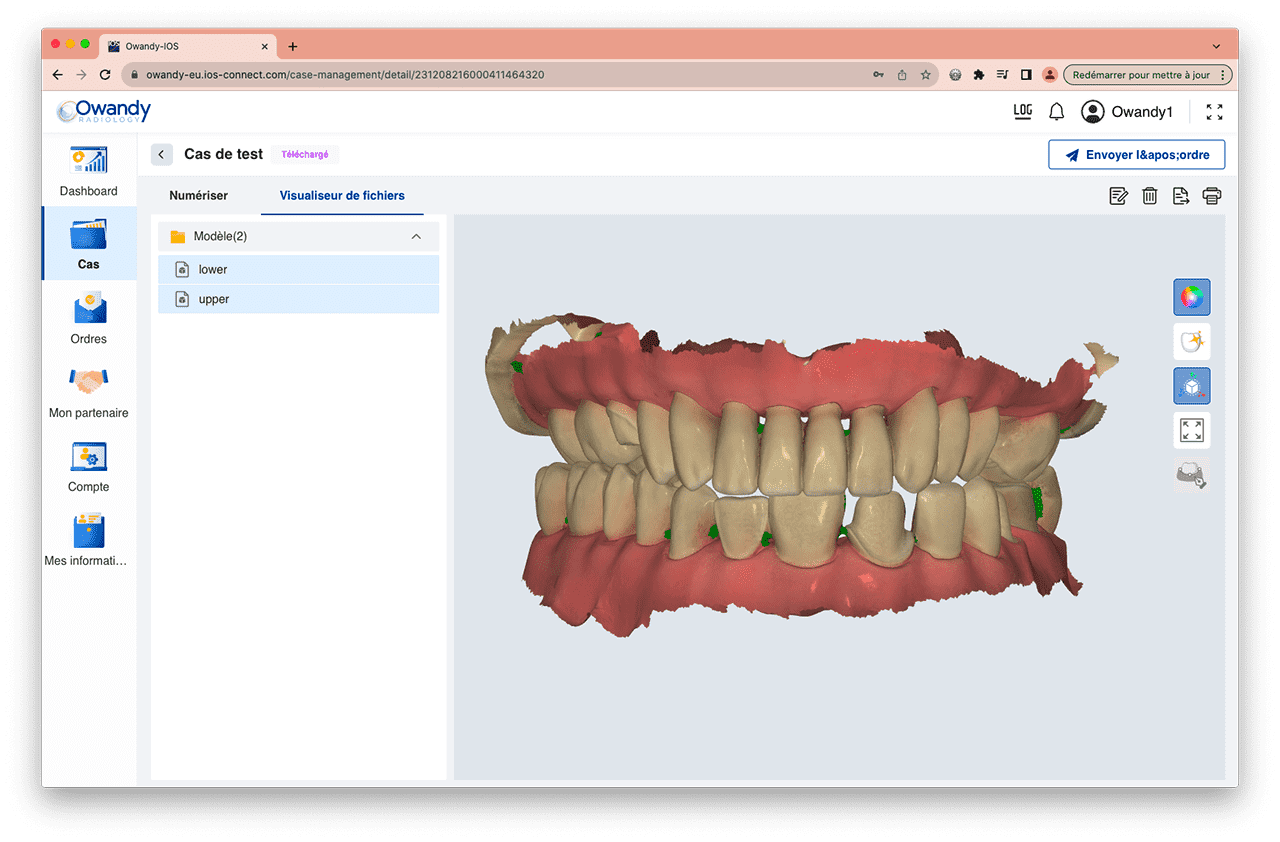 Skanery stomatologiczne optyczne 3D Owandy IOS