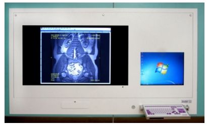 Stacje przeglądowe obrazów medycznych na sale operacyjne ULTRAVIOL DICO 1M 47" stacja przeglądowa obrazów