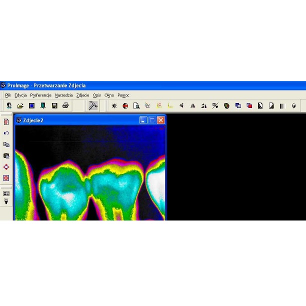 Stomatologiczne detektory cyfrowe EVA Digital Intraoral X-Ray