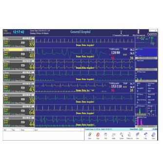 Systemy holterowskie EKG DM Software CardioVision