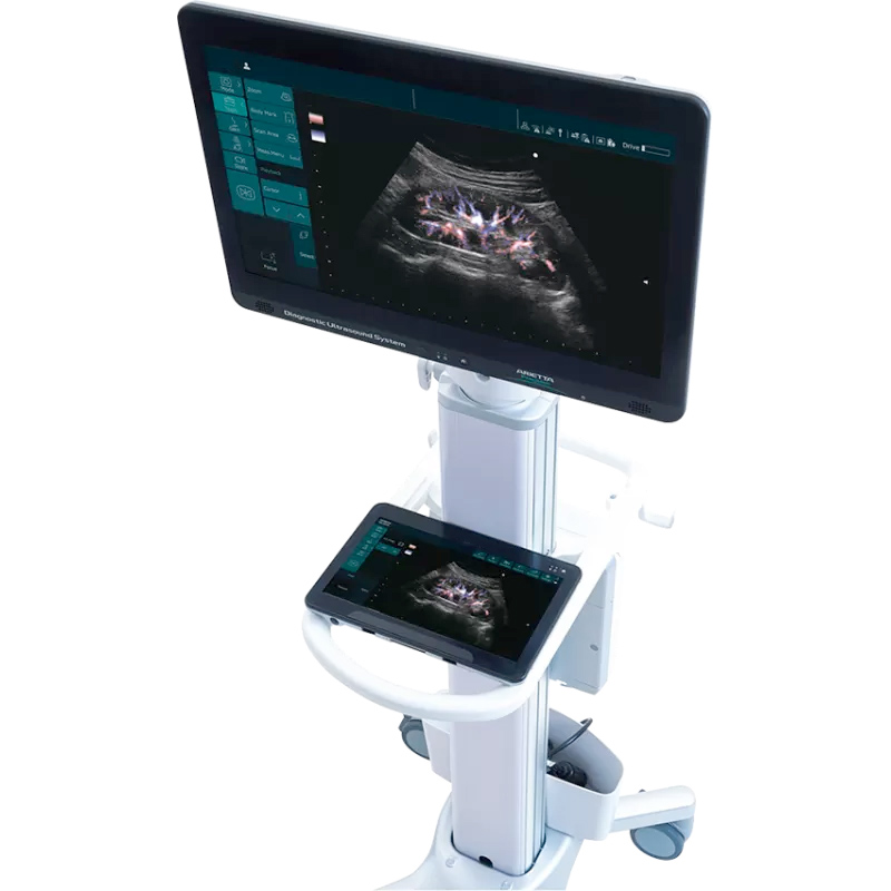 Ultrasonografy mobilne przyłóżkowe FUJIFILM Arietta Precision