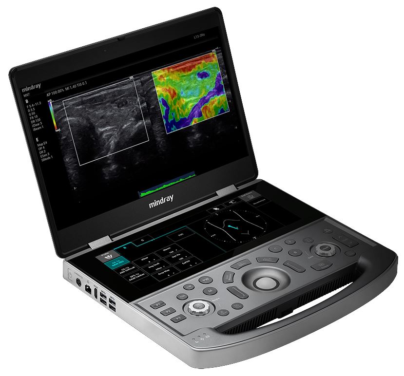 Ultrasonografy mobilne przyłóżkowe MINDRAY MX7