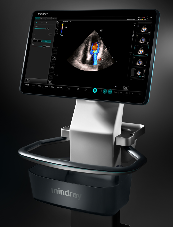 Ultrasonografy mobilne przyłóżkowe MINDRAY TEX20