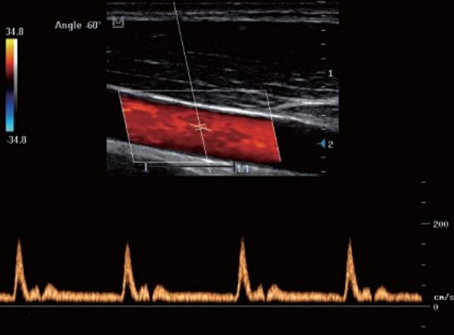 Ultrasonografy mobilne przyłóżkowe MINDRAY Z-6