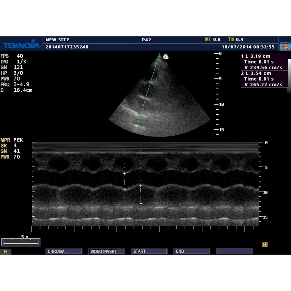 Ultrasonografy stacjonarne wielonarządowe - USG Teknova TH 5500 Expert