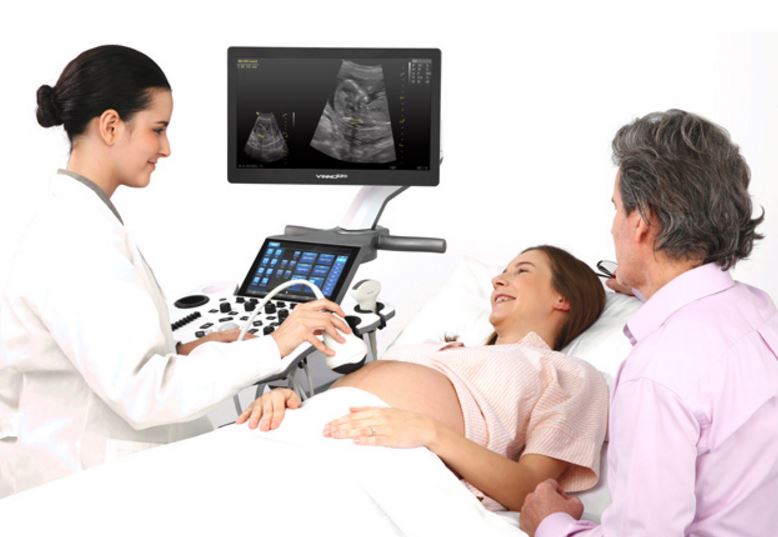 Ultrasonografy stacjonarne wielonarządowe - USG Vinno Vinno E20