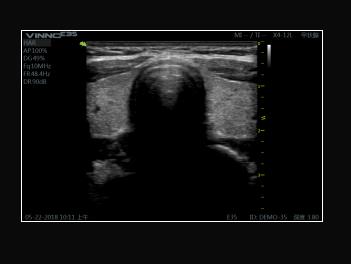 Ultrasonografy stacjonarne wielonarządowe - USG Vinno VINNO E35