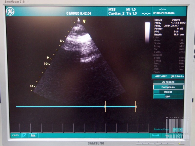 Ultrasonografy wielonarządowe używane B/D GE Vivid 7 - Praiston rekondycjonowany