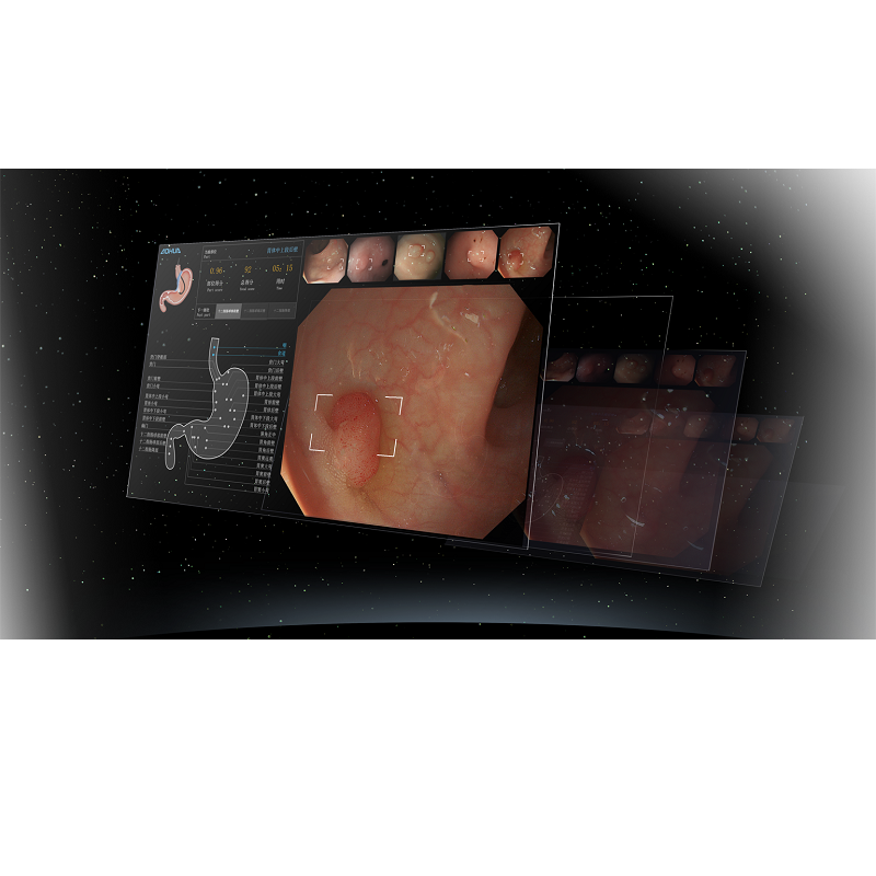 Zestaw  videoendoskopowy - gastroskopowo-kolonoskopowy AOHUA AQ300