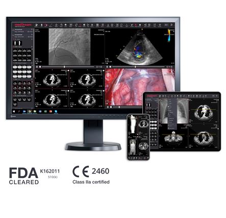Diagnostyka obrazowa - oprogramowanie IT4KAN MedDream DICOM Viewer