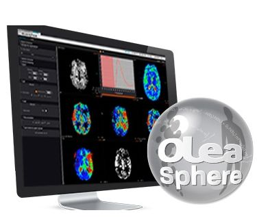 Diagnostyka obrazowa - oprogramowanie Olea Medical Olea Sphere