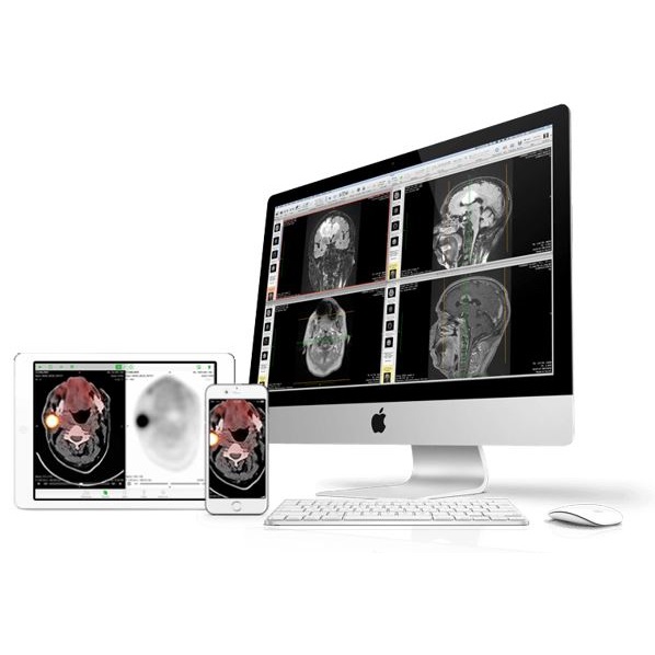 Diagnostyka obrazowa - oprogramowanie Osirix OsiriX MD