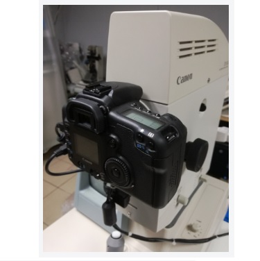 Funduskamery używane B/D Canon CR-DGi - TuOkularnik rekondycjonowany