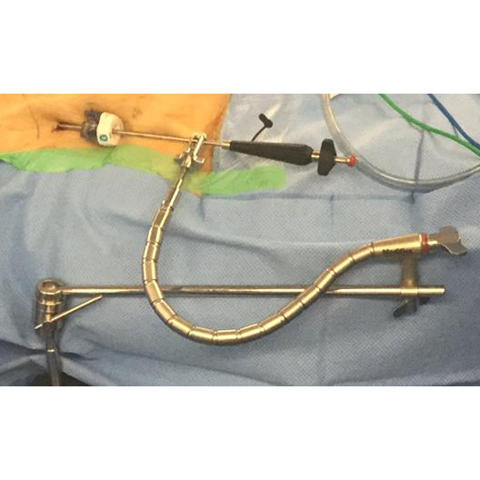 Haki automatyczne - Systemy retraktorów chirurgicznych Mediflex Whipple Bariatric Holdin