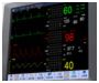Kardiomonitory przyłóżkowe Shenzhen Comen Medical instruments STAR8000A