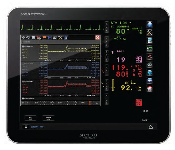 Kardiomonitory przyłóżkowe SPACELABS XPREZZON