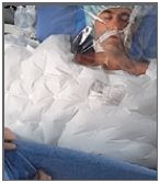 Koce i mankiety do aparatów do ogrzewania - ochładzania pacjenta Gaymar TC2054