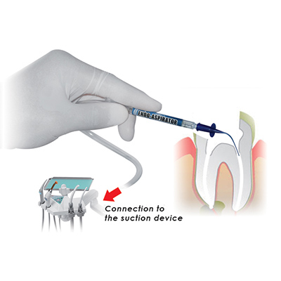 Końcówki do odsysania płynów z kanału korzeniowego Cerkamed Endo – Aspirator