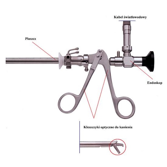 Litotryptory urologiczne sztywne Medicon Litotryptory urologiczne sztywne