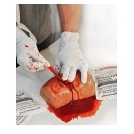 Modele zabiegowe Luna inc. TrueClot